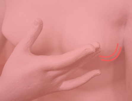 origem-outubro-rosa
